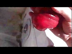 Monster Extrem Asshole Anus After Gape Hole Prolapse