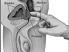 Selber massieren prostata prostata selbst